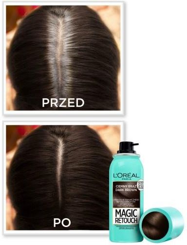 szampon loreal na odrosty